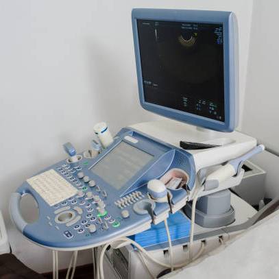 超音波診断装置